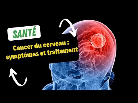 Cancer du cerveau : symptômes et traitement