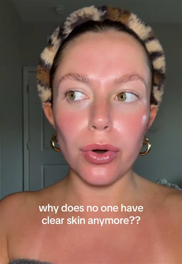 Spironolactone for Acne: Real Talk & Clear Skin