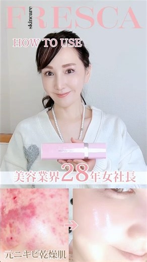 ざらつく人集合！モチモチ肌の秘訣は？