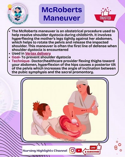 👩‍🍼McRobert Maneuver- Prevent shoulder dystocia during childbirth #nursing #norcet #aiims #labour