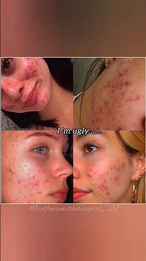 beautiful imperfect like nature "💭🌸🌷#trending #aesthetic #explorepage #viralshort #nature #imperfect