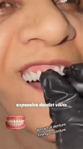 🇺🇸 Let's be real—who hasn’t been burned by cheap dentures? You save up, dream of enjoying a juicy burger or laughing freely again, but what do you get? A plastic nightmare that rubs your gums raw, slides all over when you talk, and makes eating feel like a battle! And when you try to get your money back? The seller vanishes faster than you can say "refund"! Losing cash sucks, but losing the confidence to smile? That’s just wrong. 😡 But guess what? Your denture nightmare ends NOW! Our dentures