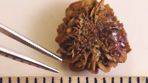 Large Bladder Stone That Has Been Stock Footage Video (100% Royalty-free) 6716455 | Shutterstock