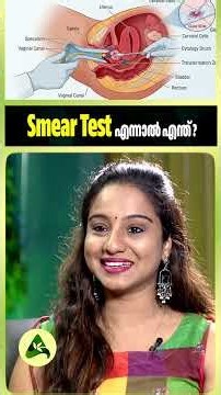 Smear Test എന്നാൽ എന്ത്? #PapSmearTest #CervicalCancer