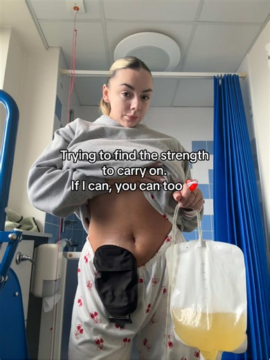 12 days later I am still in hospital 😭 They’ve found another nasty infection so I am on strong IV antibiotics every 6 hours for the next 5 days 😔 ❤️‍🩹 It’s so lonely in here and I feel so sad about everything that’s happening - trying to stay strong but I am so tired and fed up. But I will get through it and anyone else in the same position, you will too ❤️