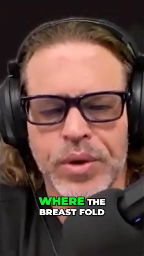 When a patient's nipple-areolar complex is low set after breast augmentation, proper alignment with the breast fold is key. If the breast fold's original position is unclear due to the procedure, measurements (17-20 cm from notch to areola edge) guide accurate placement, especially when anatomy is distorted. #BreastAugmentation #CosmeticSurgery #NipplePlacement #PlasticSurgery #ReconstructiveSurgery | Breast Implant Illness Expert