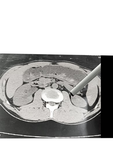 Atta Ullah Radiology 7374 on TikTok