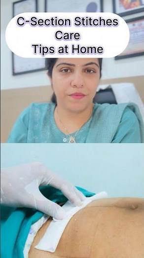 How to heal fast after C-Section | Dr RITU | Gynecologist