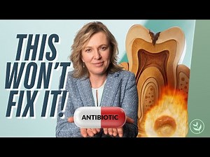 Antibiotics Won't Cure Your Tooth Infection