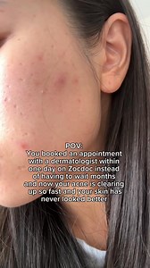 Ready for clearer skin? Zocdoc can help you find a Dermatologist who’ll create a plan that works for you. Feel more confident, even on no-makeup days.  | Zocdoc | Facebook