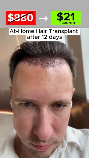 4 comments | $880 → $21/Month. Limited-Time Offer. We will never do...