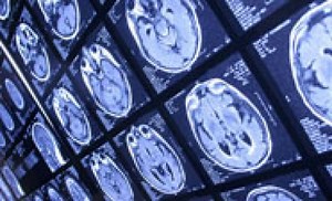 Why IQ Tests Are Bunk