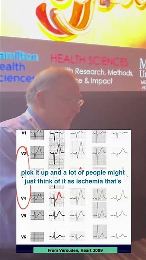 Why the de Winter T wave pattern matters with Dr. Amal Mattu 🫀⚡#ECG #medicalshorts