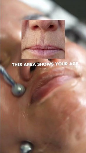 Microcurrent for Perioral Lines | Esthetician Technique