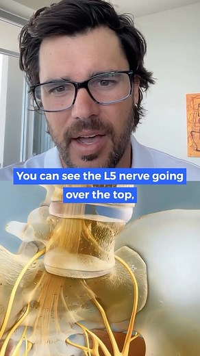 Sciatica? SI Joint pain? You gotta check this out... ⚡️ Nerves come from your spinal cord and go right past your SI joint (especially the L5 nerve), through the holes of the sacrum, then reform into your sciatic nerve. Inflammation in the SI joint can cause these nerves to be impinged or irritated. Hypertonic muscles (passively tight or stiff) can also squeeze the nerve. This can cause sciatic nerve symptoms (radiculopathy) radiating down your butt, leg, and/or into your foot. 😩 Want to heal yo