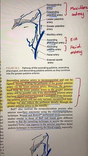 “Le Fort 1 Orthognathic Surgery: Understanding Blood Supply of Maxilla” #neetmds #mds #bds #anatomy