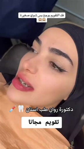 تقويم الأسنان مع دكتورة روان: خدمات مبتكرة