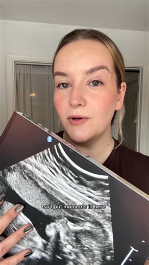 Moments are fleeting--so capture them forever. 📚 #newtraditions #2025 #photobook | Mixbook