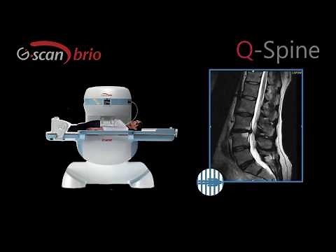 Q-Spine, the next step in MRI spine analysis
