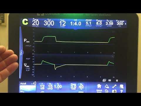 Pressure Control Ventilation [PCV] - Basics Part 1