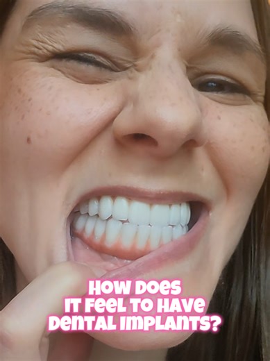 How it feels having All-on-X Dental Implants after living toothless and with removable dentures. I got my groove back! #dental #funny #dentalimplants #teeth