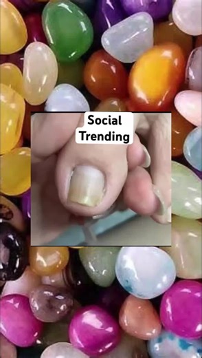 Essential Toenail Cleaning Techniques for Healthy Feet