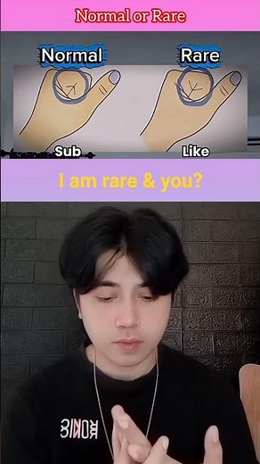 Normal or Rare? #birdtrend