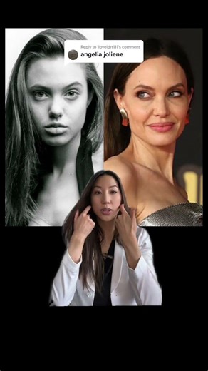 How did Angelina Jolie’s face change over the years