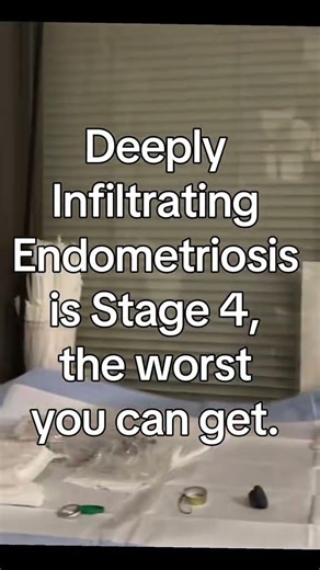 Deeply Infiltrating Endometriosis