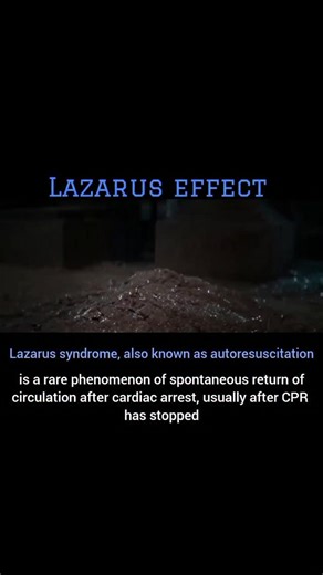 Medicinema on Instagram: "Lazarus syndrome, also known as autoresuscitation, is the rare phenomenon of spontaneous circulation returning after cardiac arrest, usually after CPR has stopped Other names for the Lazarus effect include: Lazarus phenomenon. Lazarus syndrome. Autoresuscitation after failed cardiopulmonary resuscitation When CPR ceases, this pressure drops, allowing blood flow and circulation to resume, often briefly. Air trapped in the lungs during CPR increases chest pressure, tempor