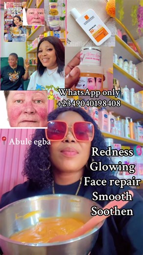 Redness repair, Glowing and soothen smooth face guaranteed. WhatsApp only 2349040198408. #skincare #glowup #recommendations #redness #tiktoknigeria🇳🇬