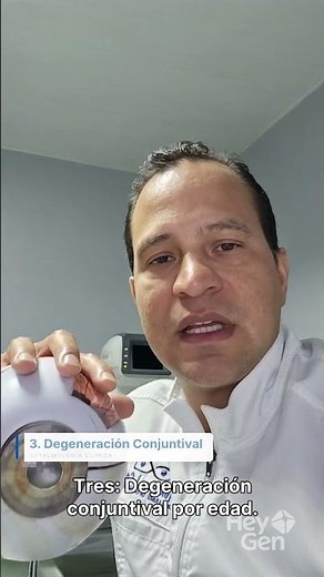 Ojos Amarillos causas oftalmologicas