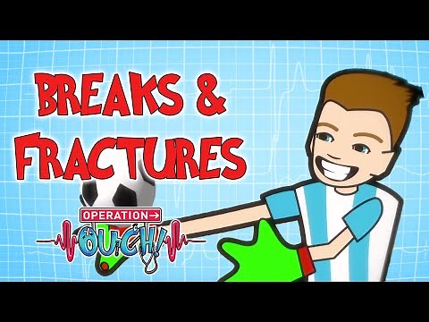 Bone Fractures & Breaks | Operation Ouch