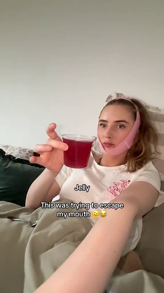 Wisdom Teeth Recovery: Day One Experience