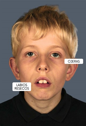 ¿Sabías que la forma de respirar moldea la cara de los niños? 👶 REGALO 🎁 Envíanos por mensaje de Instagram la palabra LIBRO 📚 y te compartimos un manual gratuito con ejercicios para restaurar la correcta postura de la lengua en niños.