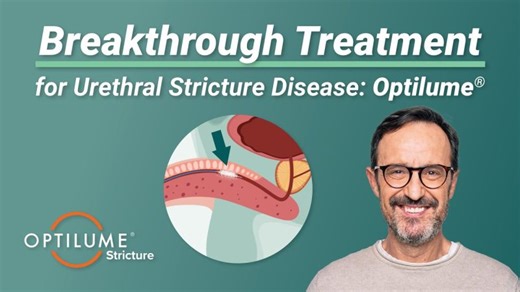 Breakthrough treatment for urethral stricture disease: Optilume | Optilume