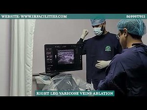 Varicose Veins Ablation in a Laughing Patient | Painless EVLA Procedure | Dr. Sandeep Sharma
