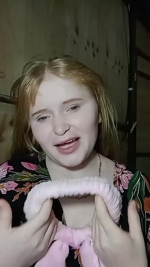 Albinos y sus características visuales