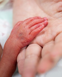 What are some of the dangers that can occur from a premature birth? #YourBodyOn | Your Body On