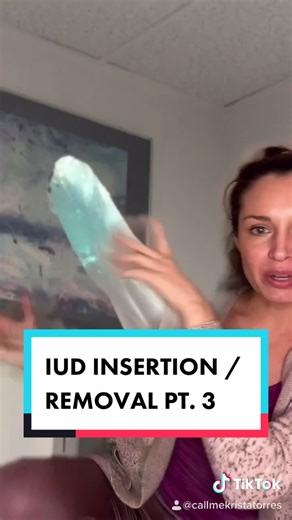 IUD Insertion and Removal Process Explained
