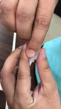 Philips New LED rope light driver installation update 929001957210 (product code)