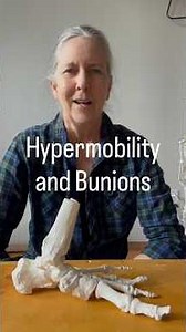 Flat, over pronated feet and/or bunions? #hEDS #halluxvalgus #rescueyourbunion