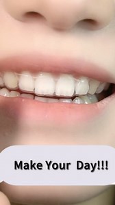 Custom Clear Mouth Retainer – 1.0 mm/1.5 mm Thickness, BPA‑Free Material, At‑Home Retainer Kit, Straight Retainer for Teeth, Nearly Invisible & Durable (Clear, Retainers 2 Set)