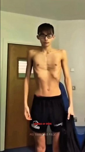 Akimbo 69 Transformation Next Level 😱 #shorts #tranding #armwrestling