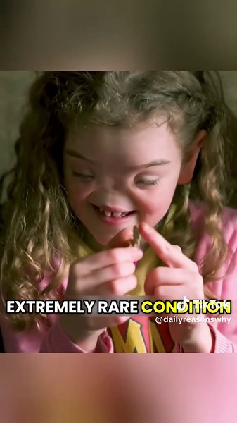 These Children Faced Unimaginable Challenges 😯 | kid videos