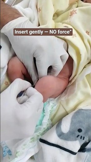 Newborn Urinary Catheterization | Using Size 4 NG Tube | NICU Skill Training#newborn #baby #shorts