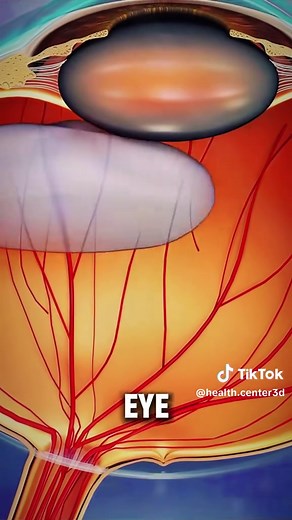 Understanding Vitrectomy Surgery: A 3D Medical Animation