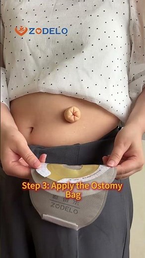 How to change One-Piece Ostomy Bag quickly - 1 piece pouch system change quide #zodelo #ostomybag