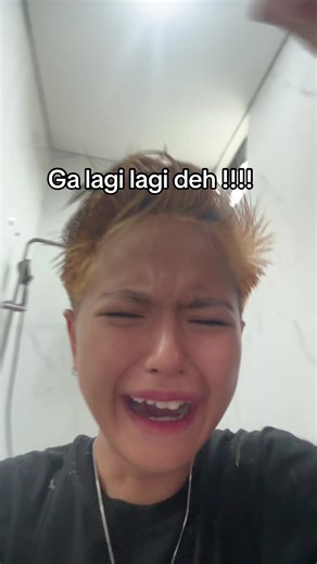 Hair Story: Solusi Ampuh Atasi Rambut Botak