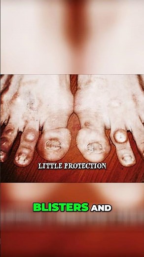 Brutal truth behind ballerina feet EXPOSED 💃🩰